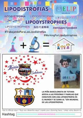 LA PEÑA BARCELONISTA DE TOTANA SE SUMA A LA CAMPAÑA DEL DÍA MUNDIAL DE LAS LIPODISTROFIAS — imagen 3