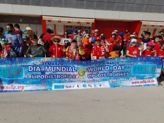 Los niños y niñas de la Escuela PB Totana  Santa Eulalia dan visibilidad a las lipodistrofias — imagen 3